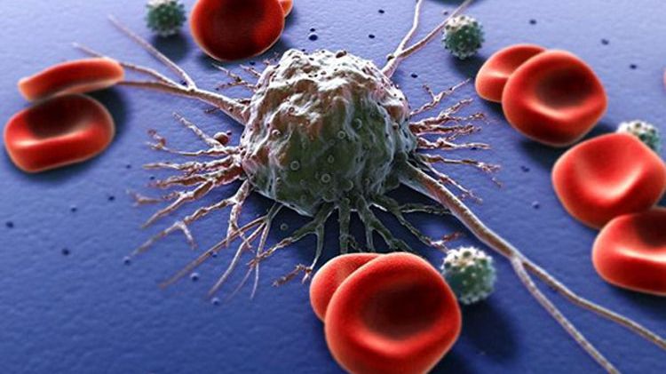 Cercetătorii susţin că două treimi din mutaţiile responsabile de cancer sunt cauzate de GHINION