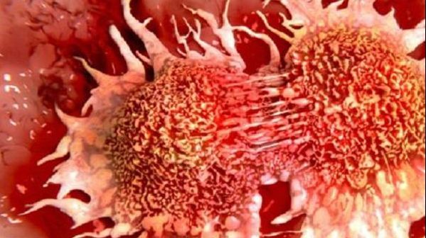 Descoperire incredibilă. Care este, de fapt, adevărata cauză a cancerului