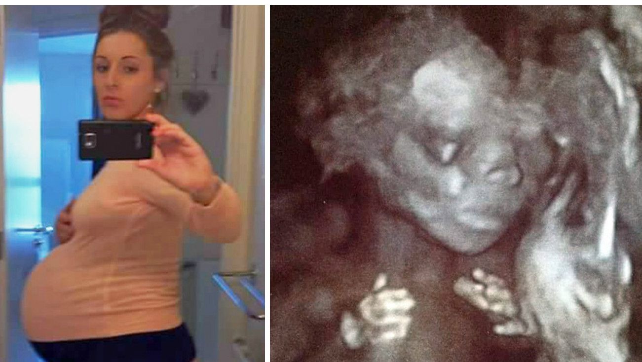 A acceptat să fie mamă surogat la doar 21 de ani. La prima ecografie, doctorii au rămas fără cuvinte