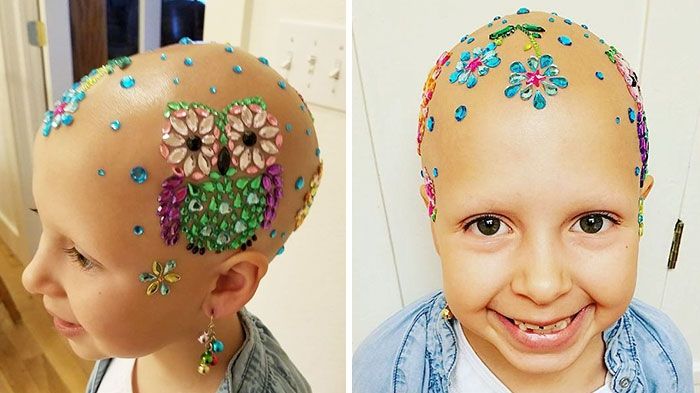 Această fetiță înfruntă prejudecățile. Cum și-a transformat dezavantajul fizic în ideal de frumusețe