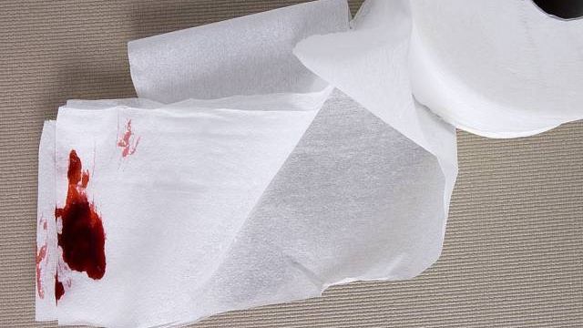 Medicii avertizează! Care sunt afecțiunile care pot provoca sângerări anale