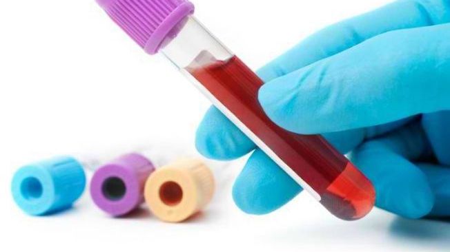 Descoperire majoră. Analiza de sânge care anunță cu 1 an înainte apariția cancerului
