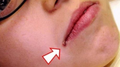 Ce probleme de sănătate poate ascunde această problemă aparent minoră? Mergi urgent la medic!