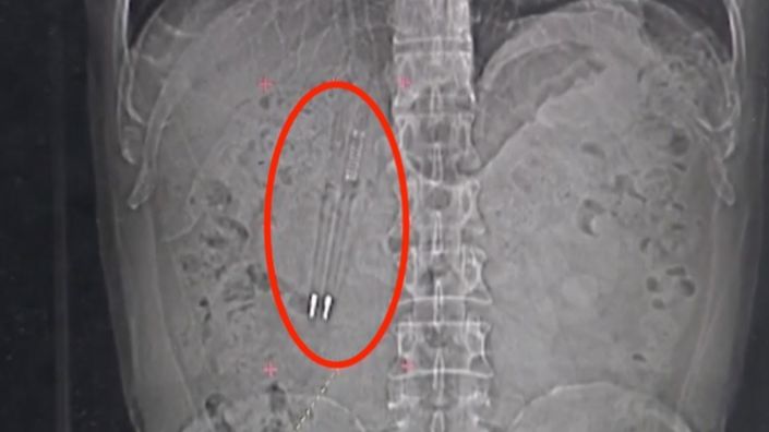 HALUCINANT! A pierdut un pariu și a suportat consecințele 36 de ani. Ce a făcut este de neimaginat