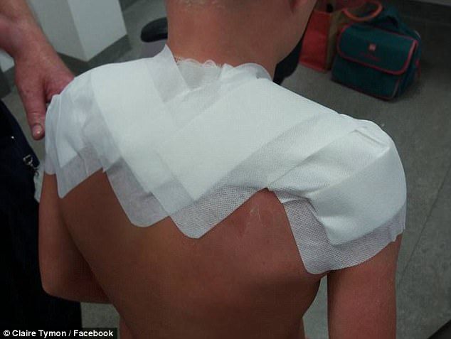 Şocul unei mame, după ce şi-a dat copiii cu loţiune de plajă cu SPF 50: "Arată ca şunca prăjită"