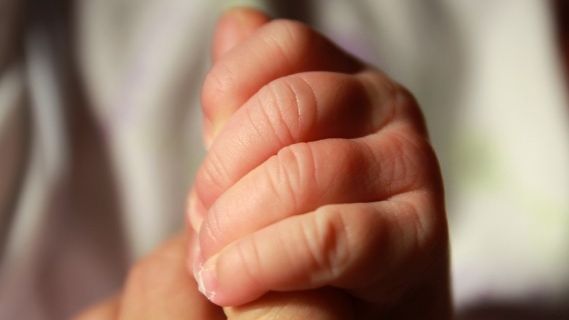Minune sau blestem? Un bebeluș s-a născut cu două capete. Medicii sunt șocați