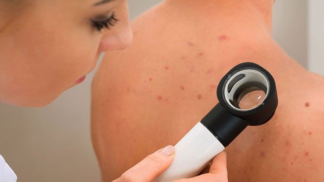 Nu te așteptai la asta. Cel mai discret tip de cancer este extrem de agresiv