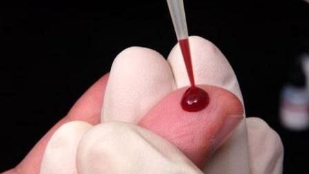 Singura ţară din America Latină care vinde în farmacii teste pentru depistarea HIV