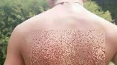 A ajuns la piscină și s-a dezbrăcat! Prietenii au rămas șocați când au văzut ce i-a apărut pe spate