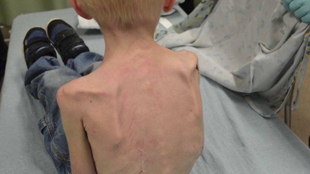 Drama copilului "portocaliu". Ce îi făceau părinții timp de 12 ore pe zi 