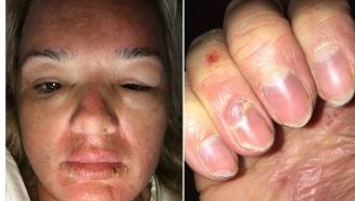 A vrut să fie frumoasă, dar a ajuns un monstru! Ce pățit această femeie după ce și-a pus silicoane