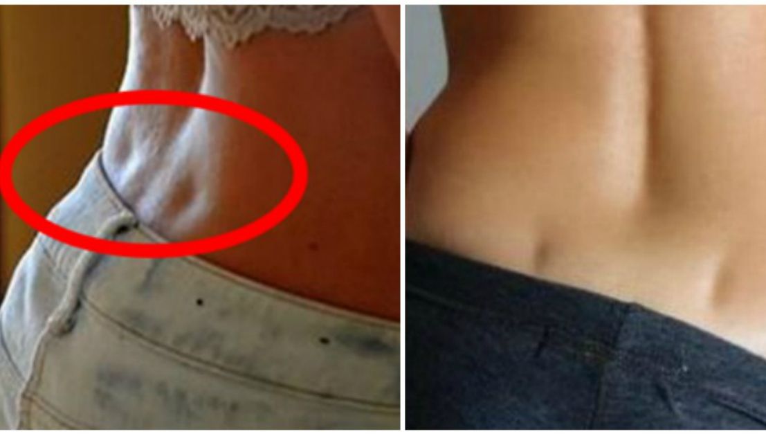 Ai "gropiţele lui Venus" în zona lombară? Care este, de fapt, semnificaţia acestora