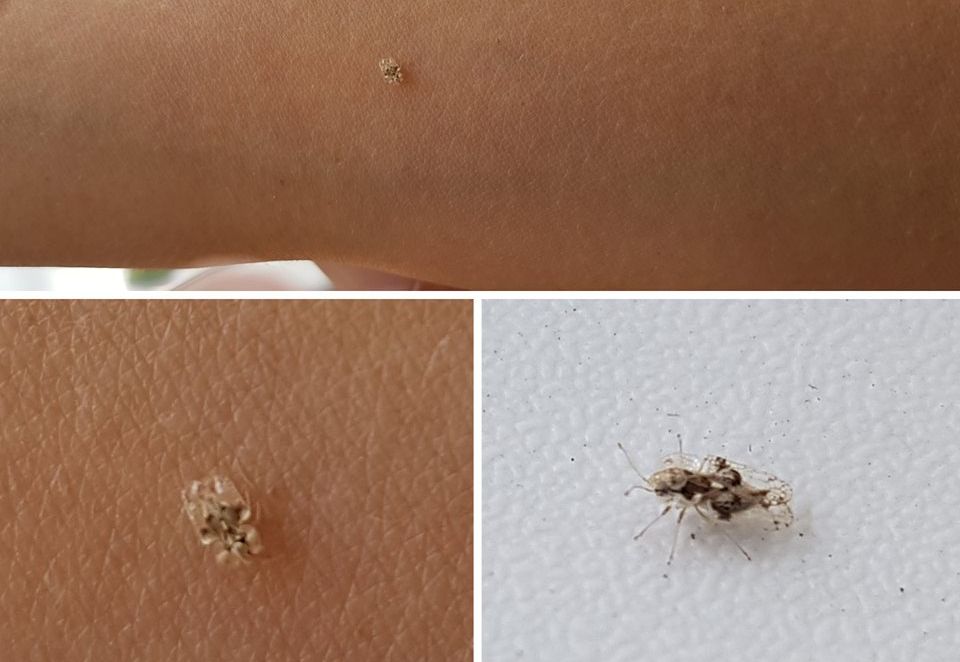Mare ATENŢIE! Iată ce este, de fapt, tigrul de platan, insecta care terorizează România