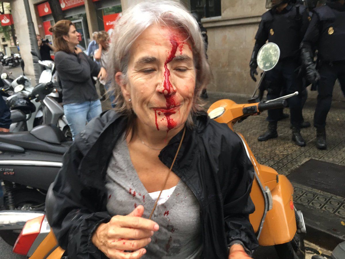 Referendum în Catalonia. Cele mai dure fotografii şi imagini video, din urma confruntărilor
