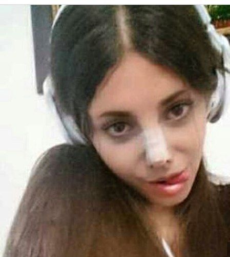 Adevărul despre adolescenta care s-a MUTILAT cu 50 de operaţii ca să arate ca Angelina Jolie