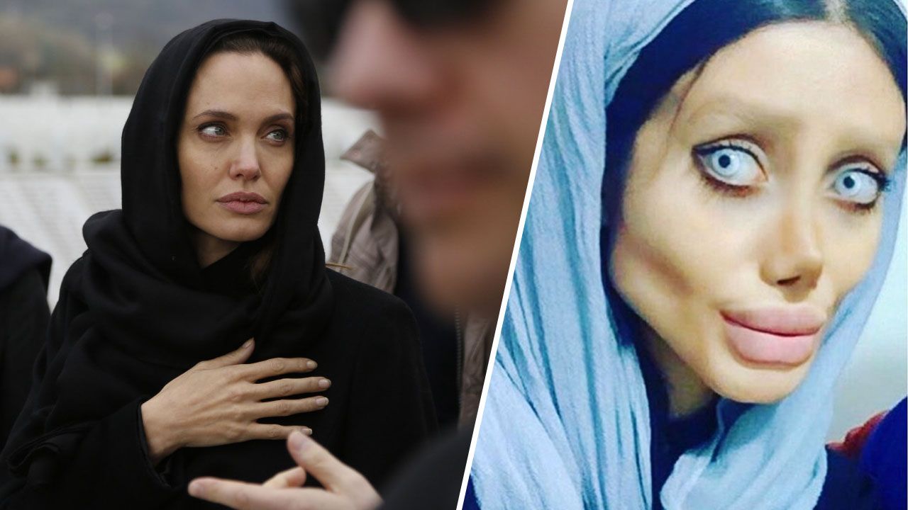 Adolescenta care a făcut 50 de operaţii estetice ca să arate ca Angelina Jolie. Rezultatul e teribil