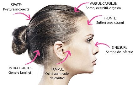 Harta durerilor de cap: Află ce boală ai în funcţie de locul unde simţi durerea