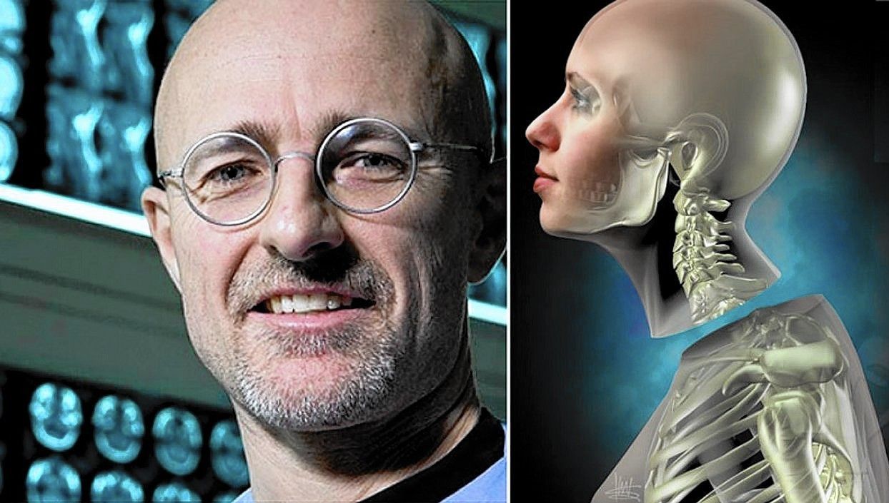 Controversatul neurochirurg care a promis primul transplant de cap uman, o nouă provocare