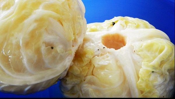 Miraculoasa dietă cu varză murată. Dai jos instant kilogramele!
