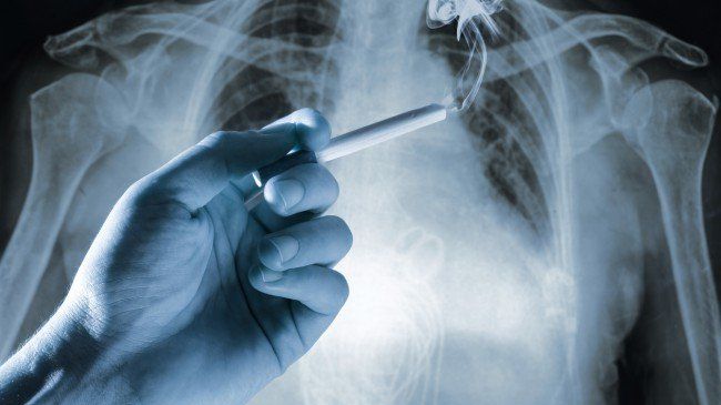 SEMNUL care anunţă cancerul pulmonar