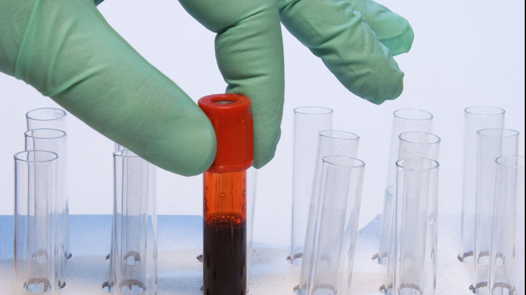 Criza de imunoglobulină continuă. Medic: "Imunoglobulina trimisă de minister e un ALT fel"