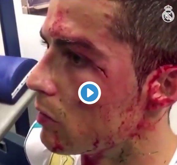 Imagini crunte cu Cristiano Ronaldo, accidentat