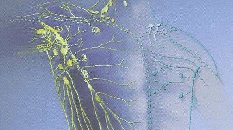 Cum să detoxifici sistemul limfatic