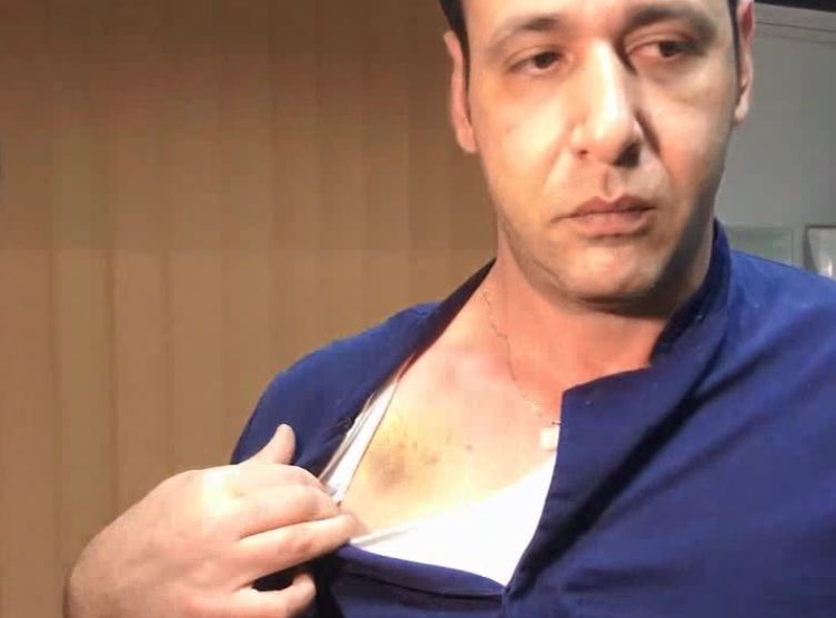 Medic bătut crunt în spital. Agresorul de 26 de ani a fost reținut