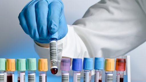 Descoperirea va schimba lumea: Analiza de sânge care depistează până la 8 tipuri de cancer