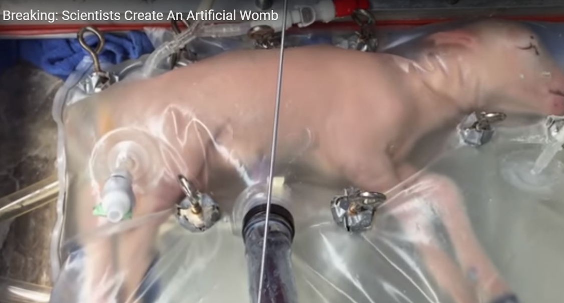 Acesta e viitorul. Primii foetuşi crescuţi în uterul artificial extern