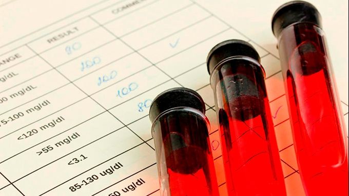 Analize de sânge pe care trebuie să le faci obligatoriu