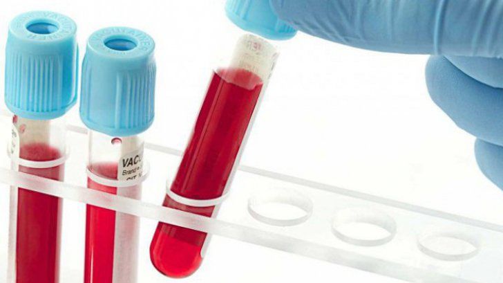 Analiza de sânge care depistează cancerul. Rezultatele sunt uimitoare
