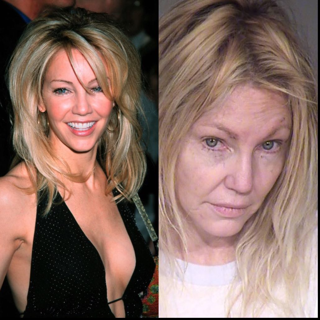 O celebră actriţă a încercat să se sinucidă - a ajuns la psihiatrie. Nu îţi vine să crezi cum arată 