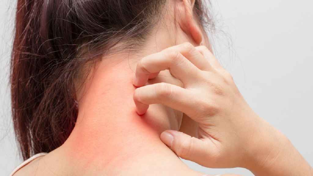 Cum afli dacă eşti alergic? Simptome şi teste pentru alergii