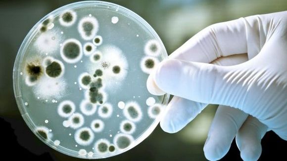 De unde poţi lua extrem de uşor virusuri şi bacterii. ATENŢIE, nici nu te aştepţi