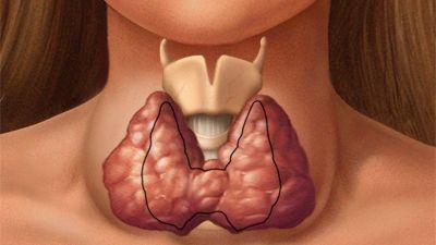 Dacă ai probleme cu glanda tiroidă încearcă să eviți aceste alimente!