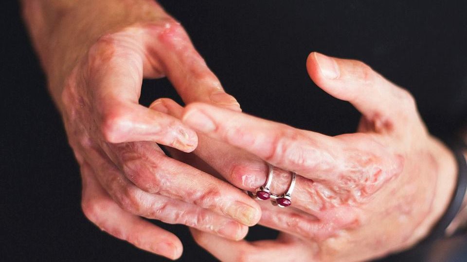 Mărturii din iad: "Nu avem NIMIC pentru arşi. Au trecut 3 ani de la Colectiv"