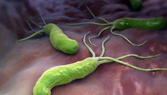 Infecția cu bacteria Helicobacter pylori