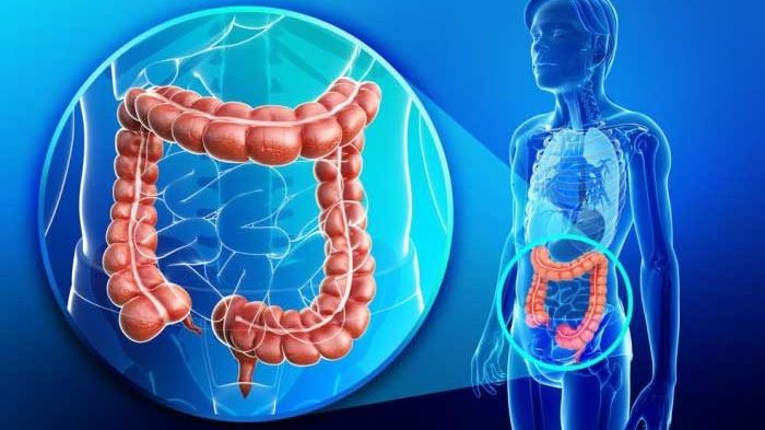 De ce apare ocluzia intestinală? Simptome și tratament