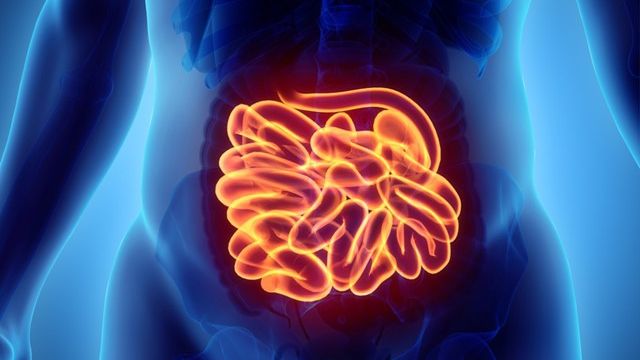 Cancerul de intestin subțire: Cauze și simptome