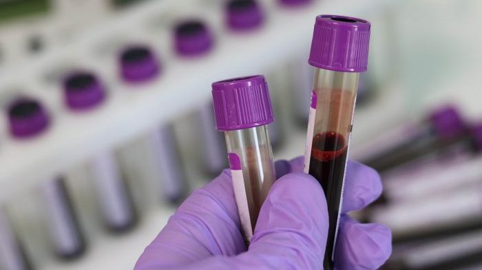 Cancerul cu cele mai mari șanse de vindecare