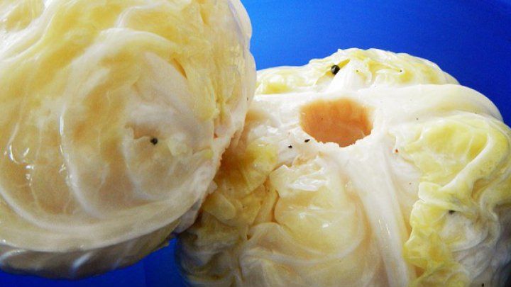 Beneficiile uimitoare ale verzei murate: face minuni pentru organism. Cât de des trebuie să o consumi 