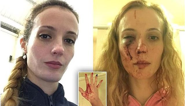 O tânără mamă din România, victima unui atac rasist în UK: M-au lovit cu pumnii și genunchii în față