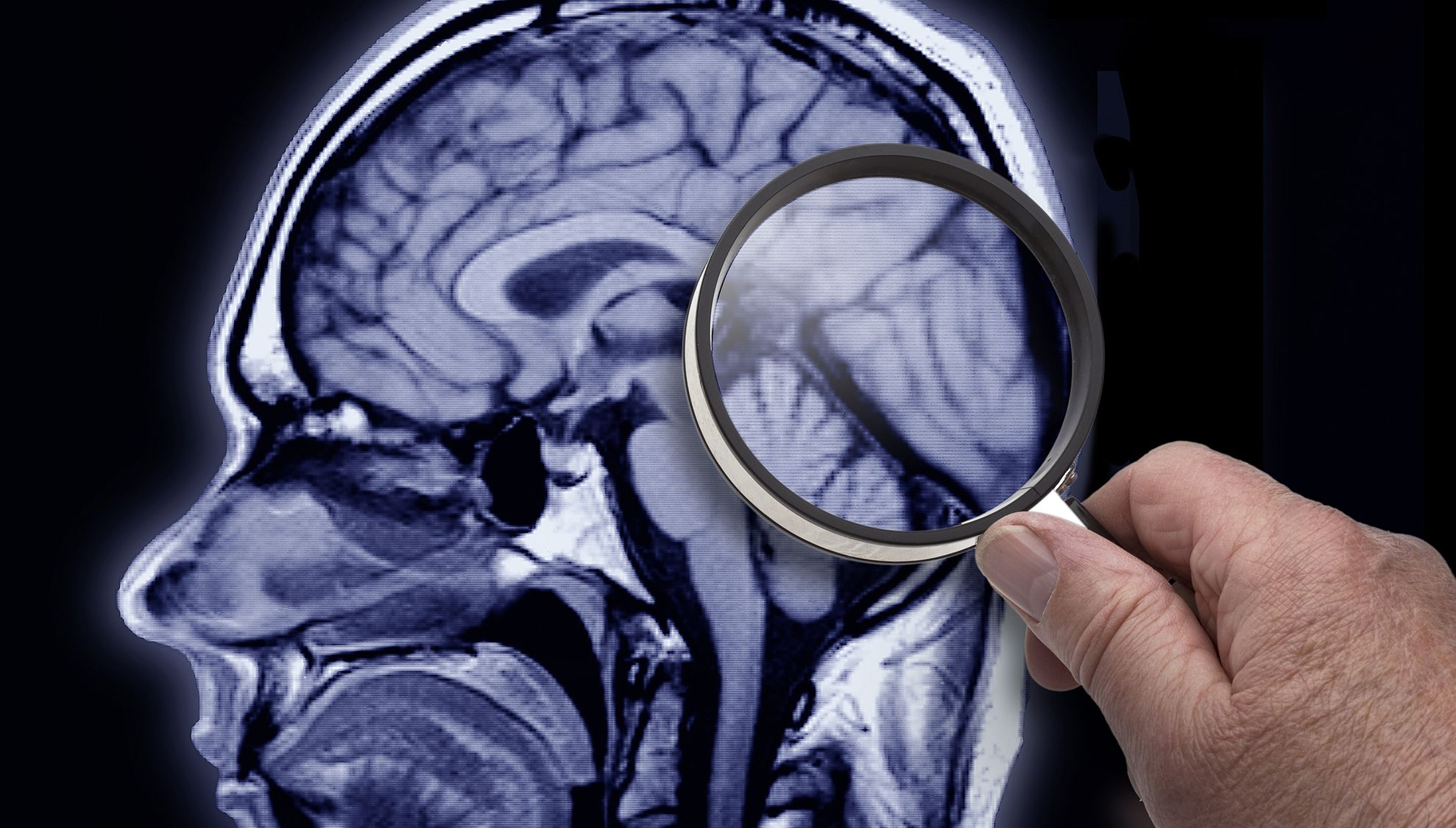 Cum o să poți uita ce vrei: specialiștii știu cum să șteargă amintiri din creier!