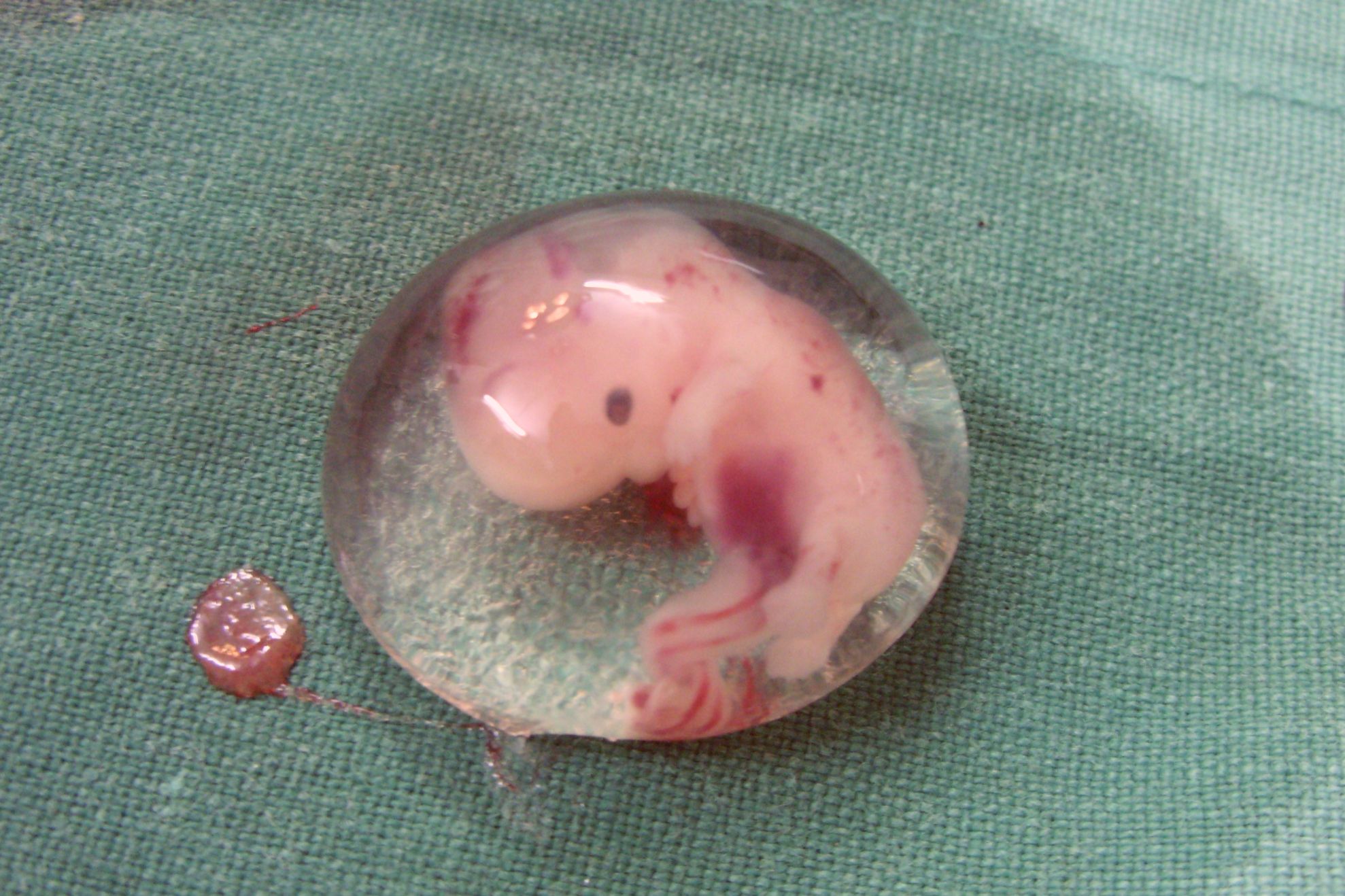 Embrioni umani sintetici