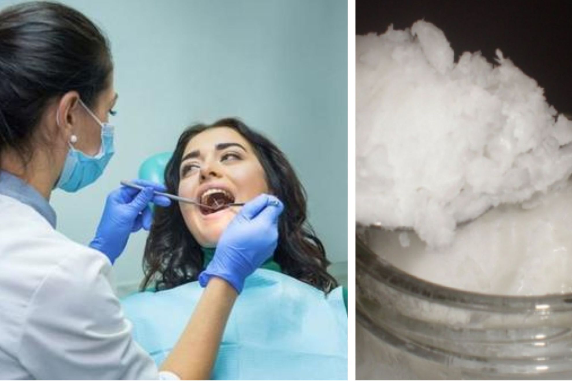Cum scapi de carii în cel mai scurt timp. Descoperirea uimitoare care te fereşte de dentist