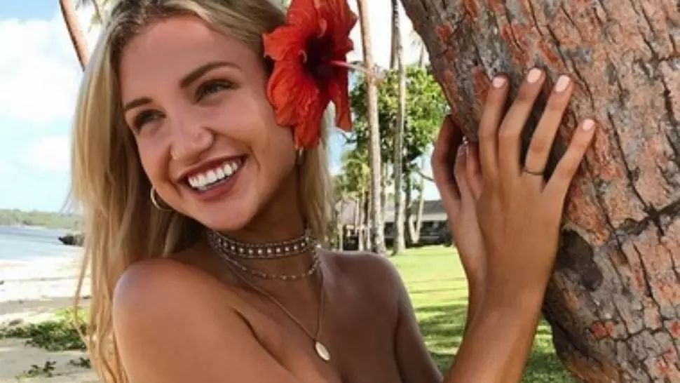 Poza ca un corp perfect, dar şi-a arătat cicatricea. Ce a păţit în secunda următoare a şocat