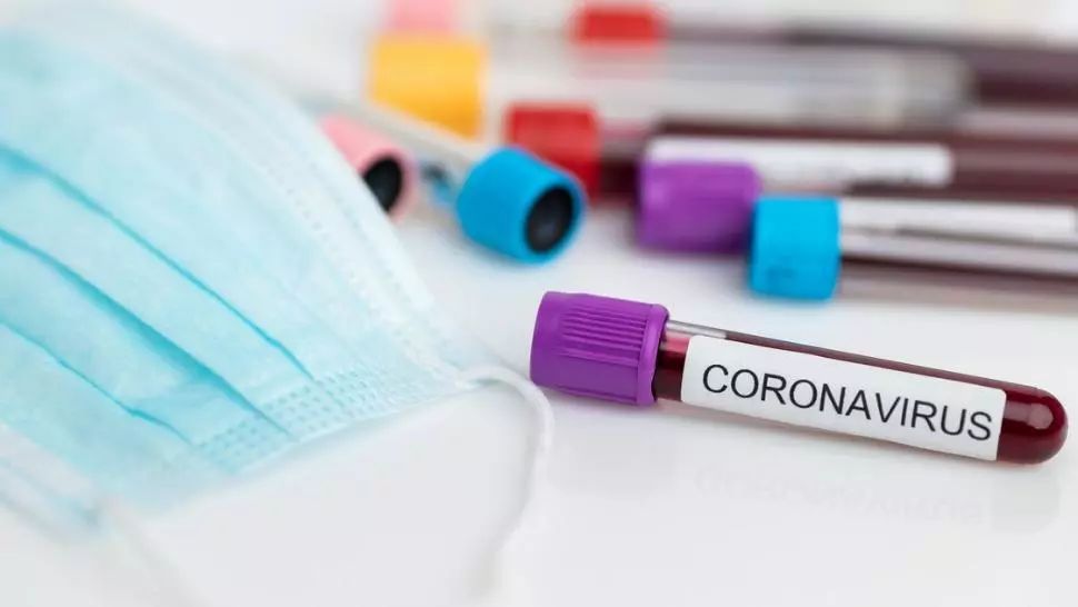 Coronavirus. Ce a făcut Israelul pentru 100.000 de teste COVID-19