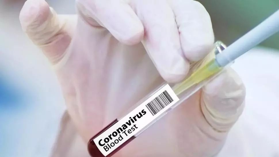 Bilanț oficial: 68 de decese cauzate de infecție cu coronavirus, în România