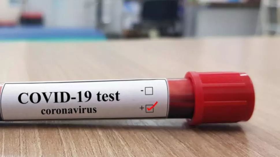 coronavirus test